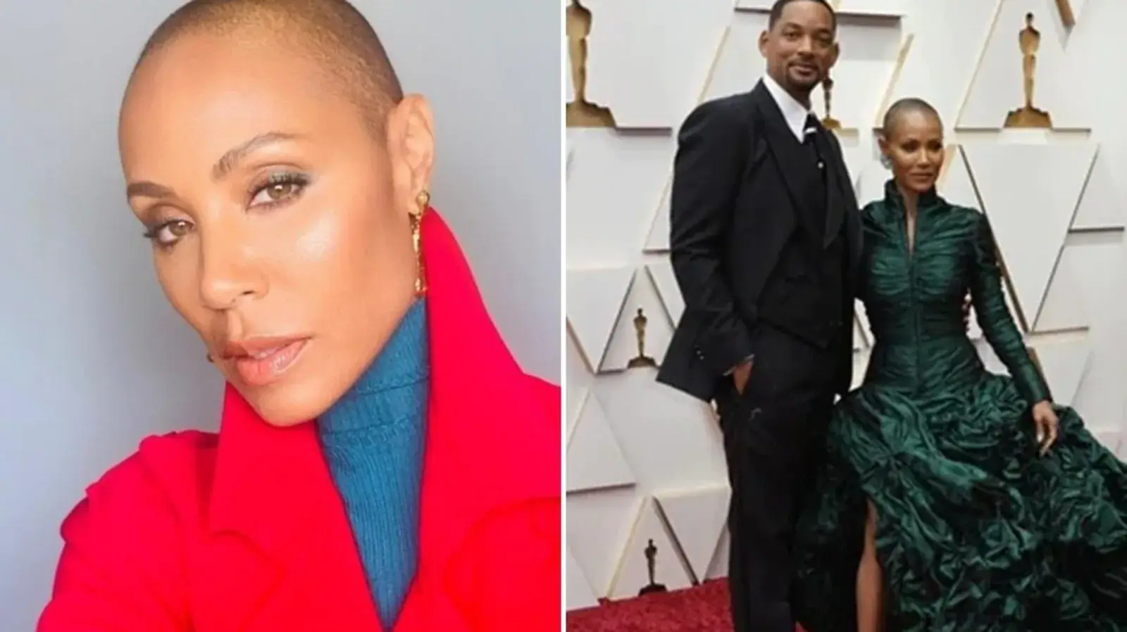 Jada Pinkett Smith- Health Condition