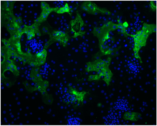 How dangerous is HKU1 Covid-19 Variant?